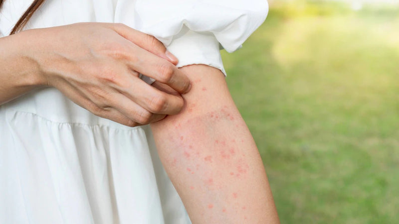 Sea Moss Allergy: Essential Facts and Prevention Tips